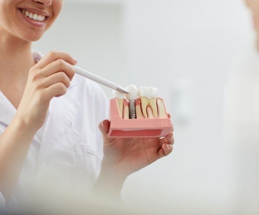 Dentist showing a patient a dental implant model