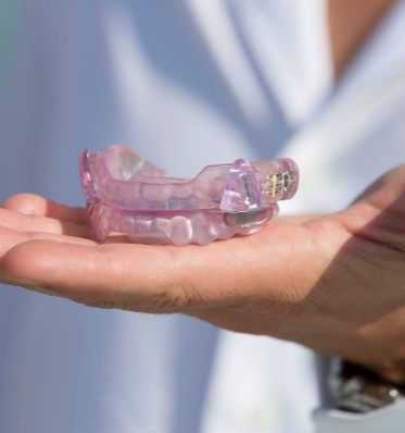 Hand holding a light purple occlusal splint