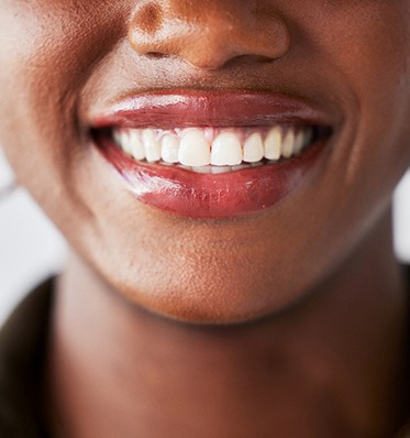 a closeup of a woman’s smile